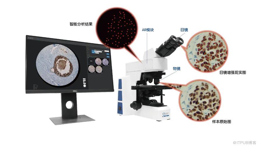 騰訊AI Lab造出中國第一臺臨床應用智慧顯微鏡！